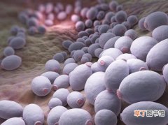 妇科霉菌感染是怎么引起的_霉菌性阴道炎反复发作