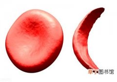 红细胞偏低是什么原因，贫血和红细胞有什么关系