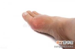 痛风在脚的哪个位置图，痛风急性发作只会在大脚趾上