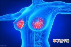 早期乳腺癌有什么症状，提示乳腺癌早期。预防乳腺癌