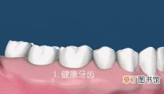牙齿松动可以修复吗，牙龈萎缩牙齿松动有办法补救吗