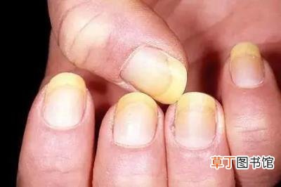 指甲开裂是什么原因，指甲出现这几种变化