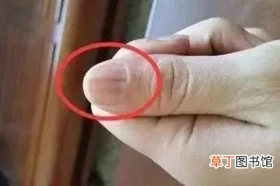 指甲开裂是什么原因，指甲出现这几种变化