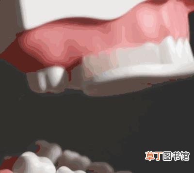 牙齿酸酸的怎么回事，为什么牙齿也会酸痛