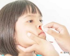 流鼻血的正确处理方法是什么