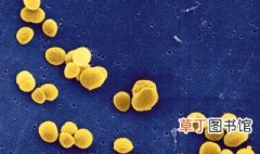 金黄色葡萄糖菌预防措施 如何预防金黄色葡萄球菌