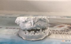 牙齿的结构是什么