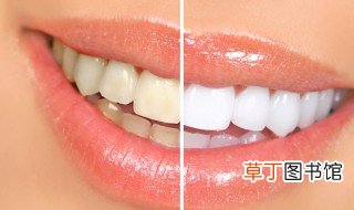 美白牙齿的最有效方法 美白牙齿的最有效方法是什么