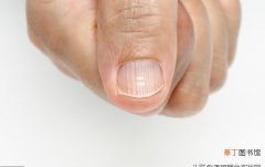 指甲有竖纹是怎么回事 手指甲上有竖纹是什么原因