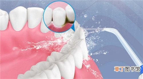 冲牙器的危害表现在几个方面 如何正确选择冲牙器