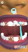 模拟经营类游戏假牙医生想要快速矫正牙齿的方法所在