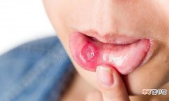 口腔内起过包的解决办法 嘴里面起泡怎么办什么原因