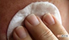 消肿止痒的六个缓解方法 被蚊子咬了怎么消肿