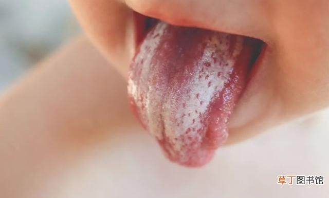 舌头有时候会变白是为啥 舌头发白什么原因