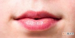 嘴唇老是干裂的原因 嘴唇起皮干裂缺什么维生素