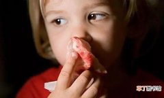 儿童流鼻血需引起重视的情况分析 六岁孩子流鼻血是什么原因引