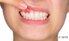 牙龈出血与这4个因素有关 最近牙龈老是出血是什么原因