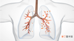 白肺病的症状和原因是什么呢,怎么判断自己白没白肺