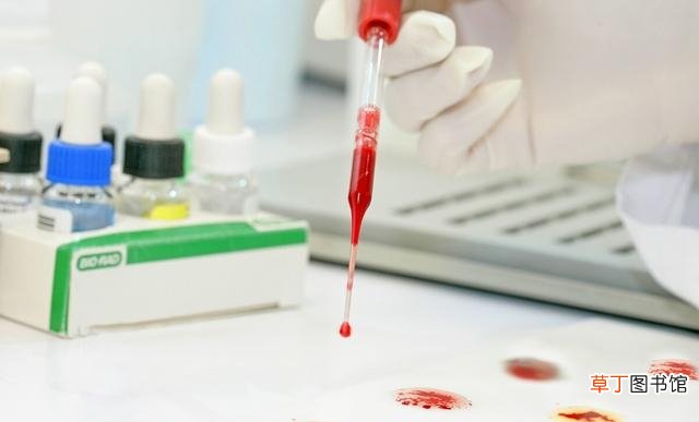 盘点世界上最稀有的血型 全球最稀有血型有哪些