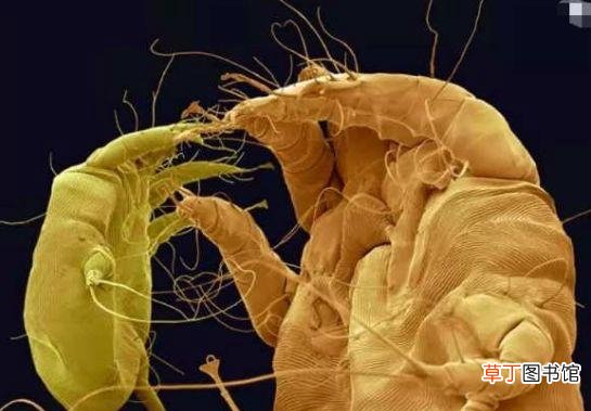 寄生虫到底长什么样1600倍显微镜下的寄生虫高清图