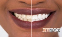 纯钛牙是什么材质 牙是什么材质