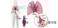 肺栓塞溶栓期可否吸氧,肺栓塞溶栓治疗过程中注意事项有哪些