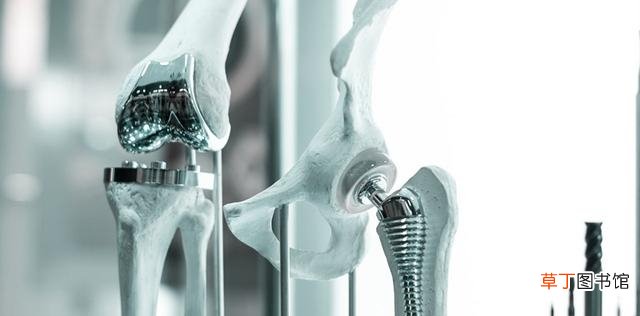 股骨头错位如何治疗 股骨头置换失败风险