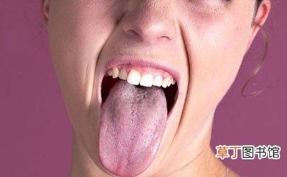 舌头烫起泡了能吃零食吗