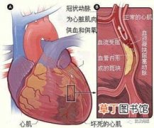 心梗胸痛在哪个位置,心肌梗死的疼痛部位及性质