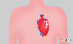 心梗做了支架可以干体力活吗,心肌梗塞做了支架手术还能做体力