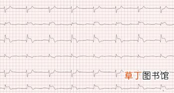 心电图能查出心梗来吗,如果有心梗在心电图上能看出来吗？