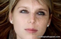 女人脸上斑点产生的原因以及消除方法