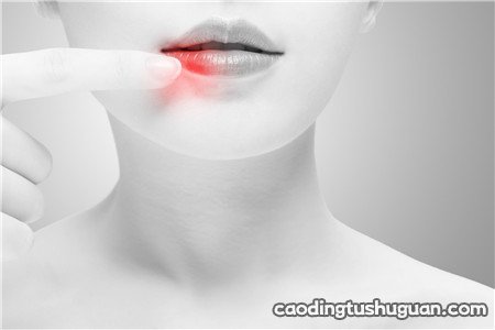 口腔溃疡会自己好吗 口腔溃疡能自己痊愈吗？