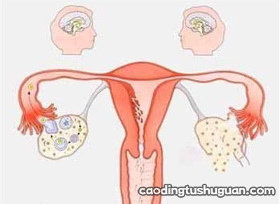 子宫内膜异位和宫寒有关系吗 宫寒和子宫内膜异位的区别
