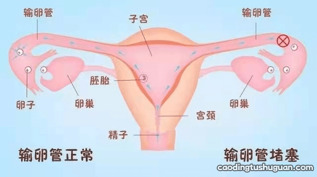 输卵管造影全程步骤